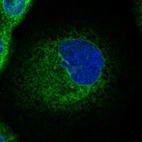 Immunofluorescent staining of human cell line A-431 shows localization to endoplasmic reticulum.