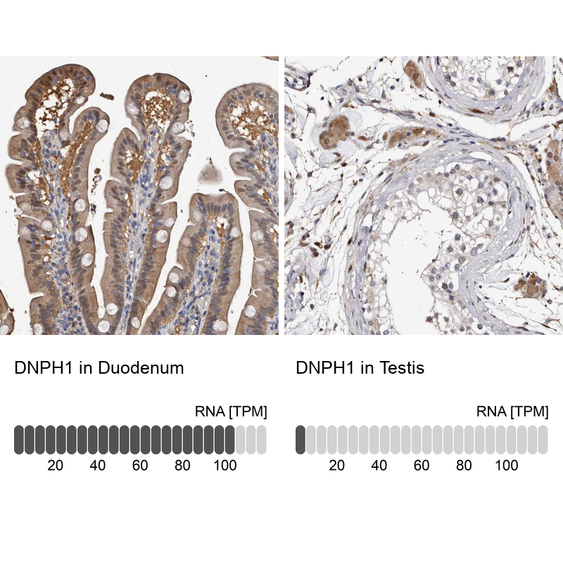 Anti-DNPH1 Antibody