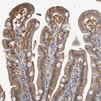 Immunohistochemical staining of human duodenum shows moderate cytoplasmic positivity in glandular cells.