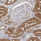 Immunohistochemical staining of human kidney shows strong cytoplasmic positivity in cells in tubules.