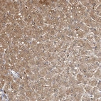 Immunohistochemical staining of human liver shows strong cytoplasmic positivity in hepatocytes.