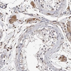 Immunohistochemical staining of human testis shows moderate cytoplasmic positivity in Leydig cells.