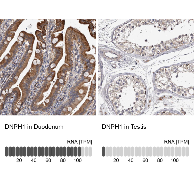 Anti-DNPH1 Antibody