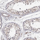 Immunohistochemical staining of human testis shows low expression as expected.