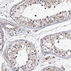 Immunohistochemical staining of human testis shows low expression as expected.