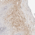 Anti-LTB4R2 Antibody