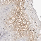 Anti-LTB4R2 Antibody