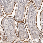 Immunohistochemical staining of human duodenum shows strong membranous positivity in glandular cells.
