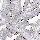 Immunohistochemical staining of human fallopian tube shows strong positivity in cilia in glandular cells.