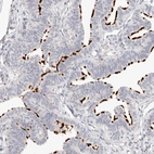 Immunohistochemical staining of human fallopian tube shows strong positivity in cilia in glandular cells.