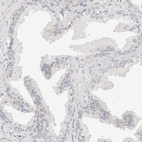 Immunohistochemical staining of human prostate shows no positivity in glandular cells as expected.
