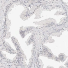Immunohistochemical staining of human prostate shows no positivity in glandular cells as expected.