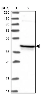 Lane 1: Marker [kDa] 230, 130, 95, 72, 56, 36, 28, 17, 11_br/_Lane 2: Human cell line RT-4