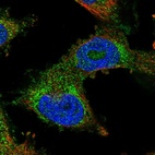 Immunofluorescent staining of human cell line U-251 MG shows localization to cytosol.