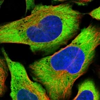 Immunofluorescent staining of human cell line U-2 OS shows localization to cytosol.