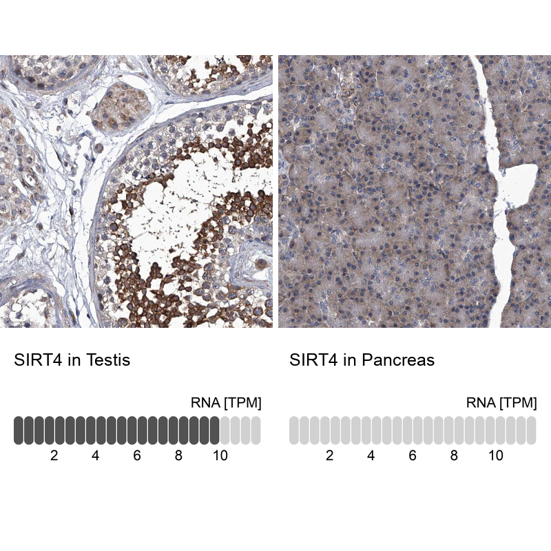 Anti-SIRT4 Antibody