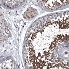 Immunohistochemical staining of human testis shows high expression.