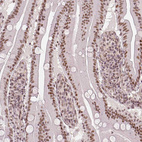 Anti-HDAC1 Antibody