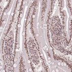 Immunohistochemical staining of human small intestine shows moderate nuclear positivity in glandular cells.