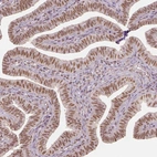 Immunohistochemical staining of human fallopian tube shows moderate nuclear positivity in glandular cells.