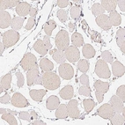 Immunohistochemical staining of human skeletal muscle shows no positivity in myocytes as expected.