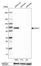 Western blot analysis in RT-4 cells transfected with control siRNA, target specific siRNA probe #1 and #2, using Anti-HDAC1 antibody. Remaining relative intensity is presented. Loading control: Anti-GAPDH.
