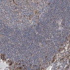 Anti-GPR132 Antibody