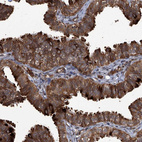 Anti-GPR132 Antibody