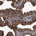 Immunohistochemical staining of human fallopian tube shows strong cytoplasmic positivity in glandular cells.