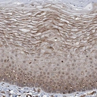 Immunohistochemical staining of human cervix, uterine shows moderate cytoplasmic positivity in squamous epithelial cells.