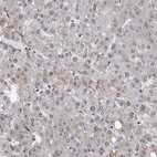 Immunohistochemical staining of human liver shows very weak cytoplasmic positivity in hepatocytes.