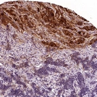 Immunohistochemical staining of human pituitary gland shows strong cytoplasmic positivity in anterior lobe.
