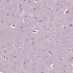 Immunohistochemical staining of human cerebral cortex shows no positivity in neurons as expected.
