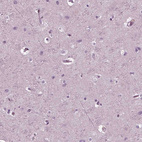 Anti-CGA Antibody