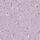 Immunohistochemical staining of human cerebral cortex shows no positivity in neurons as expected.