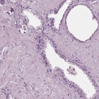 Immunohistochemical staining of human prostate shows no positivity in glandular cells as expected.