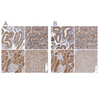 Anti-APEH Antibody