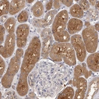 Immunohistochemical staining of human kidney shows strong cytoplasmic positivity in cells in tubules.