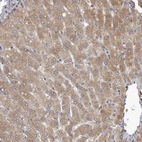 Immunohistochemical staining of human liver shows moderate cytoplasmic positivity in hepatocytes.