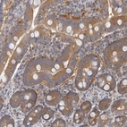 Immunohistochemical staining of human duodenum shows strong cytoplasmic positivity in glandular cells.