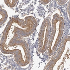 Immunohistochemical staining of human endometrium shows strong cytoplasmic positivity in glandular cells.