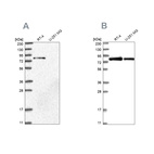 Western blot analysis using Anti-APEH antibody HPA029700 (A) shows similar pattern to independent antibody HPA029702 (B).