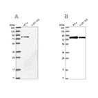 Western blot analysis using Anti-APEH antibody HPA029700 (A) shows similar pattern to independent antibody HPA029702 (B).