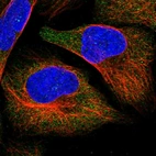 Immunofluorescent staining of human cell line U-2 OS shows localization to cytosol.
