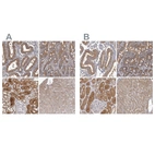 Anti-APEH Antibody