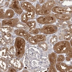 Immunohistochemical staining of human kidney shows strong cytoplasmic positivity in cells in tubules.
