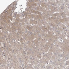 Immunohistochemical staining of human liver shows moderate cytoplasmic positivity in hepatocytes.