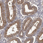 Immunohistochemical staining of human endometrium shows strong cytoplasmic positivity in glandular cells.