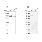 Western blot analysis using Anti-APEH antibody HPA029702 (A) shows similar pattern to independent antibody HPA029700 (B).