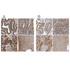 Anti-APEH Antibody